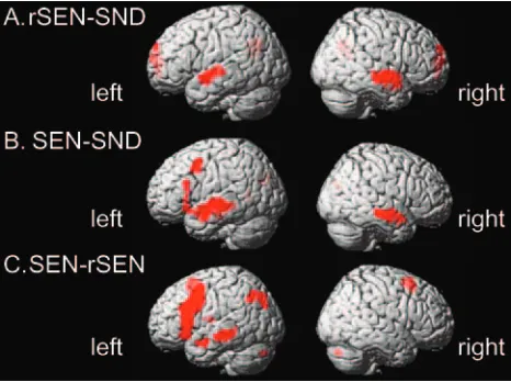 Fig 2. Activated areas revealed by the contrasts. rSEN-SND (SEN-rSEN (extent threshold at 10 voxels)