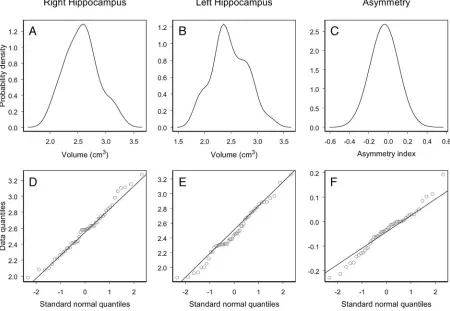 Fig 4. Empirical probability distributions and Q-Q plots for the right and left volume and asymmetry index of the hippocampus of the control population.