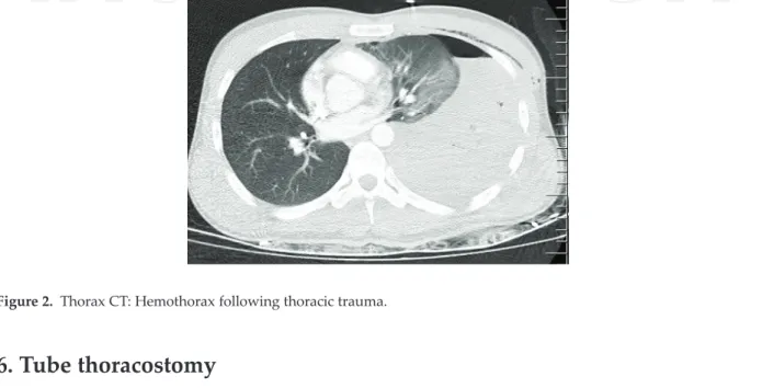 Table 1. Emergency thoracotomy indications in hemothorax.