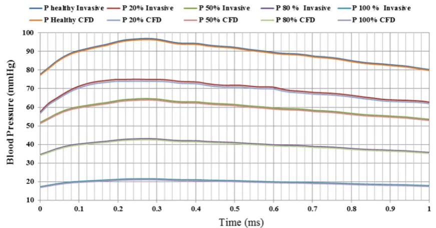 Figure 9and computational data which is encouraging for further investigation in using the CFD simulation to study the WSS and CS for the healthy condition as well as for the four  shows a minor error between the experimental arterial blockage conditions.