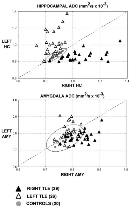 Fig 6. Scatterplots show the correlations between the ipsilateral and contralateral ADCvalues of the hippocampus and amygdala
