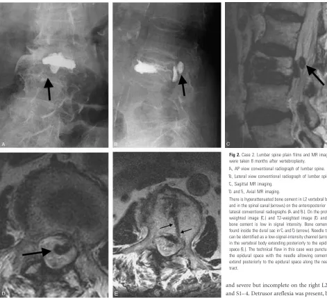 Fig 2. Case 2. Lumbar spine plain films and MR imaging