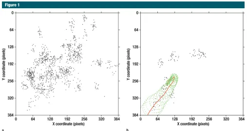 Figure 1:Figure 1 (a) Graph shows distribution of a reader’s gaze in a 25-second video clip with a 12-mm polyp