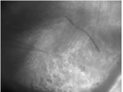 Figure 2.3: Picture taken during recording using 10x objective.  Patch pipette is on the right  and nicotine puffer pipette is on the left