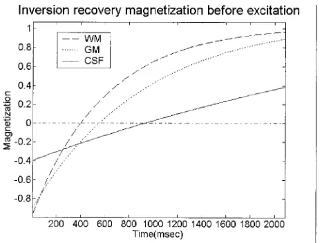 FIG 1.Behavior of longitudinal magnetization as a function ofinversion time before the application of the read-out sequence.The parameters used in these simulations are TR, 2250 millisec-onds; T1WM, 600 milliseconds; T1GM, 920 milliseconds; andT1CSF, 4200 milliseconds.