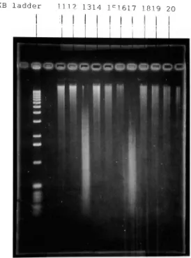 Figure 6b. An 0.8% agarose gel showing fragment distribution of samples with varyingenzyme concentrations and time of incubation, (contd.)