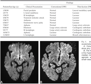 FIG 1.oculomotor nerve palsy.