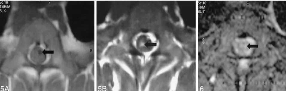 TABLE 2: Sensitivity, specificity, and PPV, and NPV of MR imaging