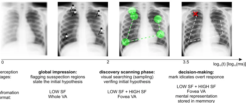 Figure 1. Graphical representation of the visual searching and detection model proposed for radiological task [9]first few hundred milliseconds a global impression about the image has been created by the brain, often without eye movements and without consc