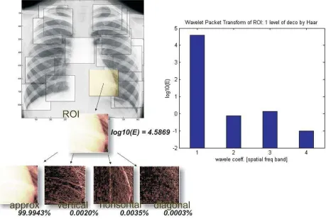 Figure 7. The general scheme of the wavelet’s methodology of medical images analysis in terms of spatial features local areas investigation