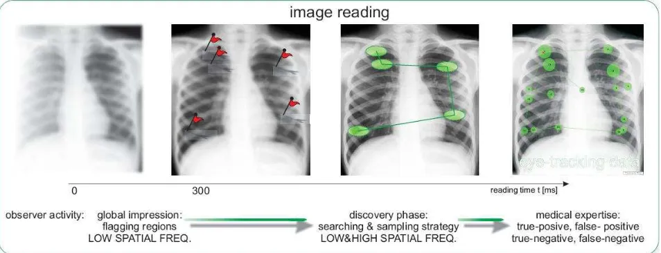 Figure 1. An chest radiographs reading schema in terms of a global-focal perception model