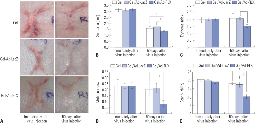 Fig. 1. Relaxin (RLX) expression reduces the size, color index, and pliability of pig scars