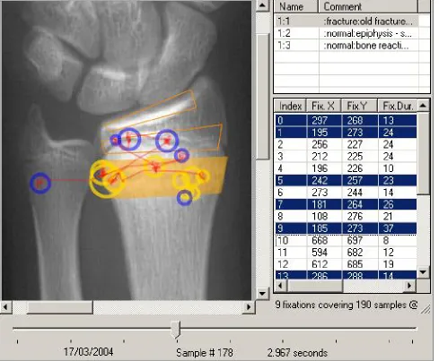 Figure 1. An example of a data window within TraceViewer. The display area (top left) provides an interactive visuali-sation of the gaze data