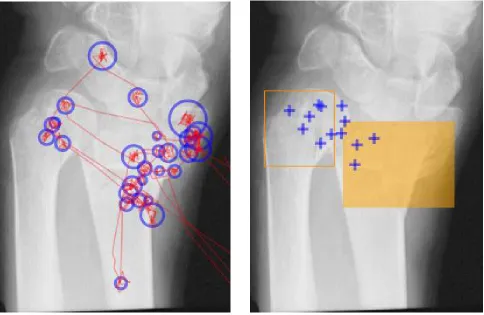 Figure 2. The four overlay features. Image 2a, left, shows the traditional saccade path and ﬁxation circle display