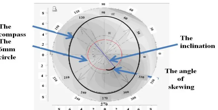 Figure 3. The compass fitting on the map and the slope to calculate the skewing angle (10)   