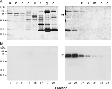 Fig. 11. Ion-exchange chromatography of Ha-CalpM. Fractions 17–23 from gel ﬁltration chromatography (Fig