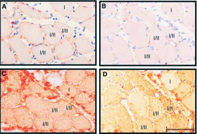 Fig. 9. Quantiﬁcation of sarcolemmal focal adhesion kinase (FAK)expression in different ﬁbre types of normal and foreign-reinnervatedrat skeletal muscles: Fibres were classiﬁed into different types andsubdivided on the criteria of FAK immunoreactivity into