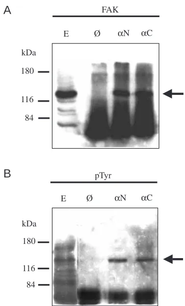 Fig. 2. Characterisation of antibodies. Triton X-100 extracts of ratnormal soleus muscle were subjected to immunoprecipitation withnormal (Ø), polyclonal rabbit antisera A-17 against the N terminus(αN) or the serum (αC) of focal adhesion kinase (FAK) again