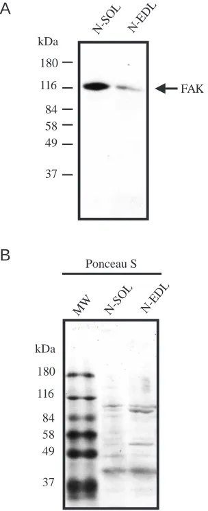 Fig. 3. Focal adhesion kinase (FAK) expression in normal slow- andfast-twitch muscle. (A) Soluble deoxycholate protein extract (10of slow-twitch normal soleus (N-SOL) and fast-twitch normalextensor digitorum longus (N-EDL) muscle was subjected toimmunoblot