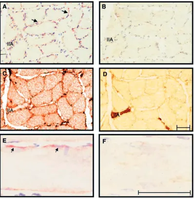 Fig. 4. Focal adhesion kinase (FAK) localisation in normal slow-twitch muscle. Immunocytochemical analysis of cross (A–D) and longitudinal(E,F) sections from slow-twitch normal soleus (N-SOL) muscle with the FAK N-terminal antiserum A-17 (A,E)