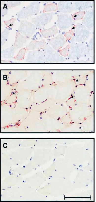 Fig. 5. Staining speciﬁcity of different focal adhesion kinase (FAK)antibodies. Immmunocytochemical analysis of FAK in parallelcryosections of fast-twitch normal extensor digitorum longus (N-EDL) muscle with polyclonal A-17 (A) and monoclonal FAKantiserum 