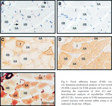 Fig. 6. Focal adhesion kinase (FAK) localisation in fast-twitch muscle.(A) Immunocytochemical analysis of fast-twitch normal extensor digitorum longus(N-EDL) muscle for FAK protein with serum A-17