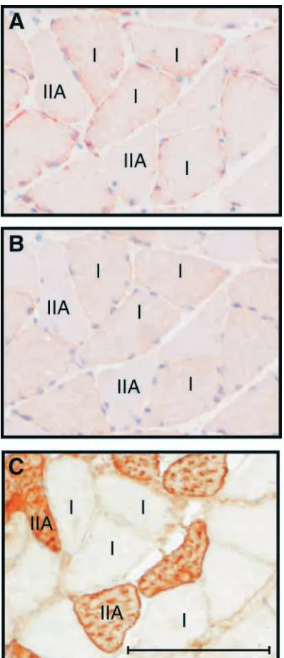 Fig. 7. Sarcolemmal focal adhesion kinase (FAK) immunoreactivityin muscle ﬁbres during the slow- to fast-twitch transformation.Sarcolemmal FAK immunoreactivity (A, FAK antiserum A-17; B,control reaction) and ﬁbre type (C, fast myosin) were determined oncon