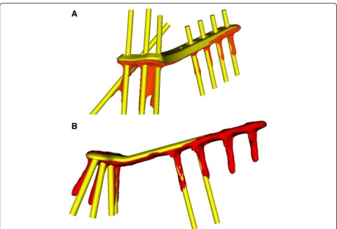 Fig. 7 Example of plate and screws of 3D planned (yellow) and obtained (orange) position of each group.with corresponding screws directions