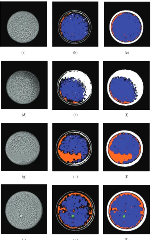 Figure 11: Example of segmentation results using threshold and hyperrectangles. (Left column) Original image with (a) denoting defect-free cathode, (d) missing material, (g) smooth area, and (j) bump