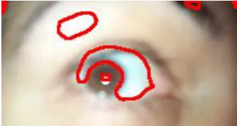 Figure 5. Image after applying Median blur,  Erode, and Dilate Operations. 