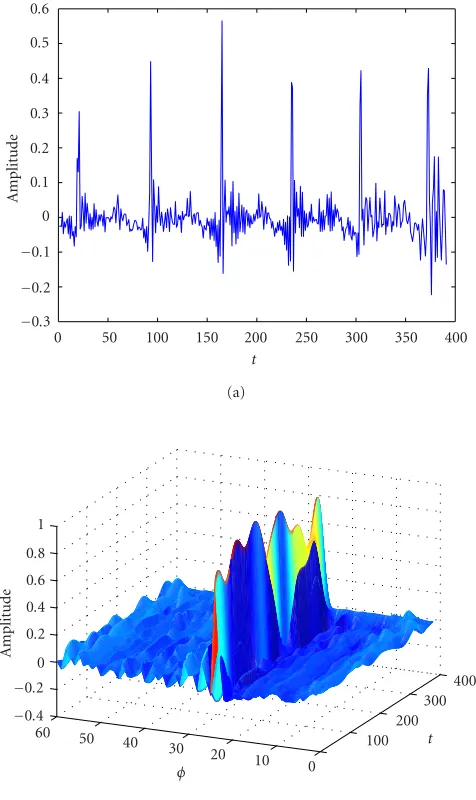 Figure 3: Creating the characteristic waveform surface. (a) A typ-ical residual error signal, derived from the speech signal using lin-ear prediction analysis