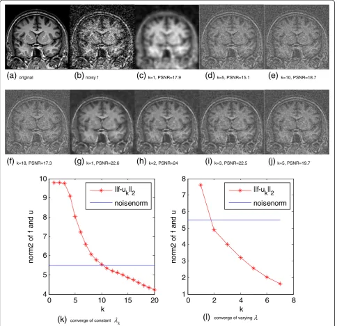 Figure 5 Denoising results of MRI coronal brain image.