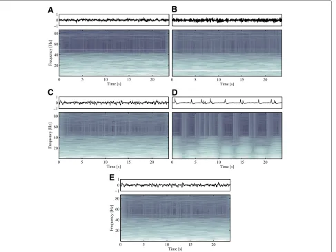 Figure 4 EEG examples. Examples of EEG recordings labeled as normal (Z,O), interictal (N,F) and ictal (S), respectively.