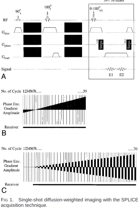 FIG 1.Single-shot diffusion-weighted imaging with the SPLICEacquisition technique.A, Sequence of RF pulses and magnetic ﬁeld gradients
