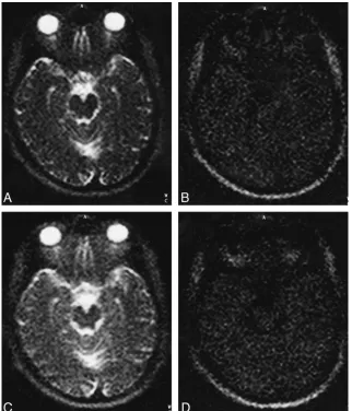 FIG 2.SPLICE images from the head of a 36-