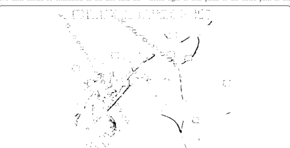 Figure 2 The location of the pixels that are detected wrongly in the corrupted Lena image, “edge pixels”.