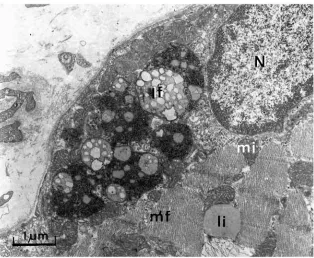 Fig. 2. Micrograph of a section of muscle tissue from a subject after exposure tochronic hypoxia