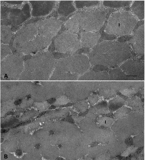 Fig. 1. Cross section electron micrographs of soleus muscle ﬁbers obtained pre-ﬂight (A) and post-ﬂight (B) from astronaut B of the 17-daySTS-78 shuttle ﬂight