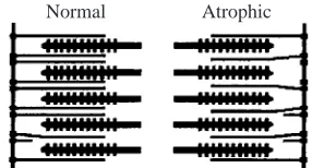 Fig. 3. Schematic representation of the in vivo status of thin-ﬁlamentpacking density and spacing in half a sarcomere from a normal pre-ﬂight muscle and in half a sarcomere from an atrophic muscle after a17-day space ﬂight in humans