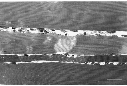 Fig. 5. Toluidine-Blue-stained, longitudinal semithin section of adductor longus muscle ﬁbers from a rat orbited in microgravity for 2 weeks inCosmos biosatellite mission 2044 and returned to terrestrial gravity loading for approximately 10h before tissue 