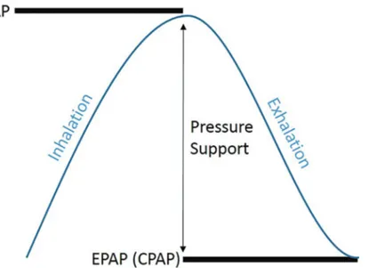 Figure 3. Schematic representing the pressure cycle provided a bi-level PAP de- de-vice