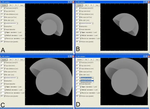 Figure 1(A) The THR Simulator and the basic figure of the generated radiograph(A) The THR Simulator and the basic figure of the generated radiograph