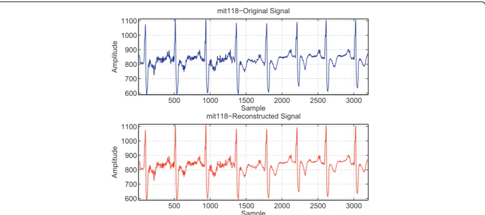 Figure 9 Comparison of the proposed algorithm with our previous method and Hilton in terms of average MPRD and CR.