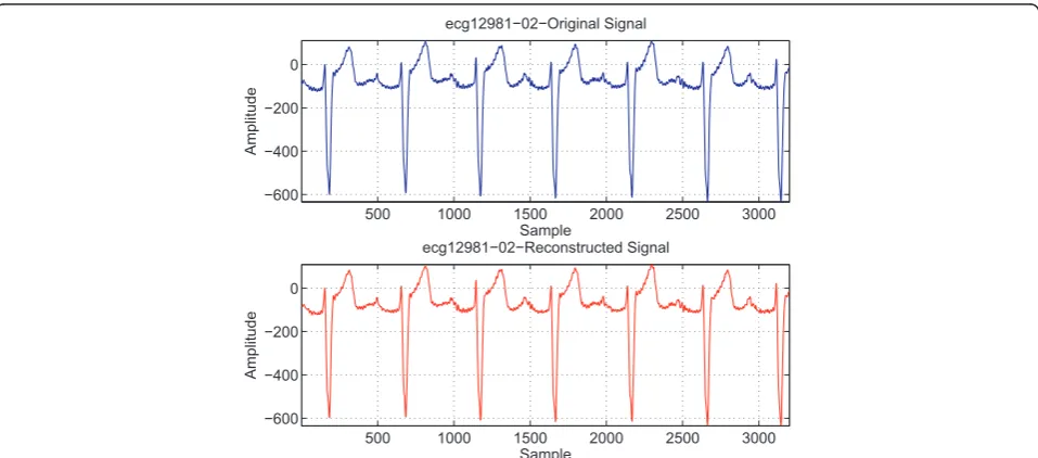 Figure 11 The original and reconstructed ECG signals of the record 117 taken from the MIT-BIH arrhythmia Database (PRD = 2.4652,CR = 17.9226, MAXERR = 4.3534).