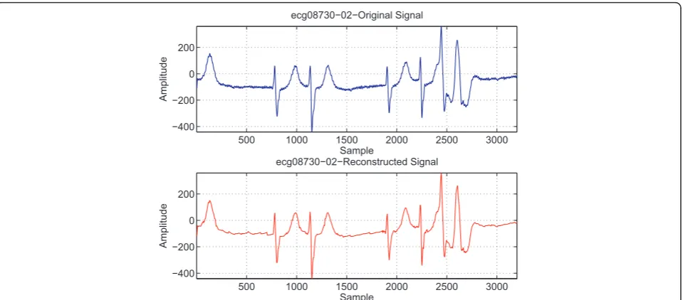 Figure 14 The variation of the average MOS, SMOSQRS, SMOST , and SMOSP with respect to the CR.