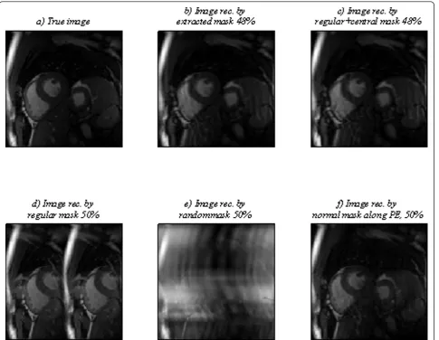 Figure 7 True and reconstructed images by different masks for time point 18. For time point 18, (a) desired image and imagereconstructed by presented iterative method and (b) extracted mask, 37.5%, used for even time points, (c) a test mask, 37.5%, including centerlines and 1/6 of the other lines selected regularly, (d) regular mask, 50%, (e) random (conventional) mask, 50%, (f) normal (conventional) mask,50%, along PE direction.