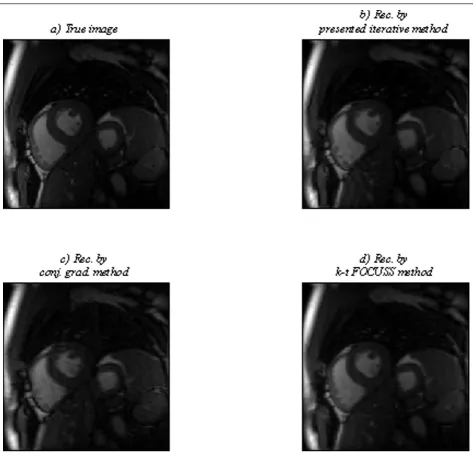 Figure 8 True image and reconstructed images by different CS-based methods for time point 18