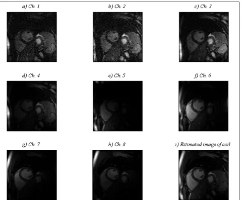 Figure 3 Estimated images of coil channels and entire coil, time point 1. (a-h) Estimated image of each coil channel corresponding to timepoint 1 by the proposed iterative method and (i) estimated image of the coil for time point 1.