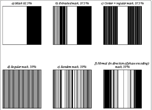 Figure 4 Different undersampling patterns (Masks). (a) 67.5% mask used for odd time points, (b) extracted mask, 37.5%, used for even timepoints, (c) a test mask, 37.5%, including center lines and 1/6 of the other lines selected regularly, (d) regular mask, 50%, (e) random mask, 50%,(f) normal (conventional) mask, 50%, along PE direction.