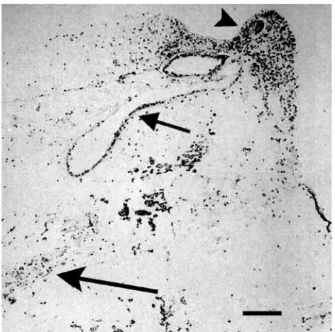 Fig. 2. Immunocytochemical localization of TGF-βStrong immunoreactivity is observed in the regenerating blastema(arrowhead) and weaker immunoreactivity in the brachial nerve(long arrow) and coelomic epithelium (short arrow) at 1 week post-amputation